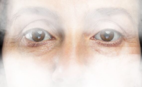 középkorú nő szemei a láthatatlanságot jelképező ködbe burkolva